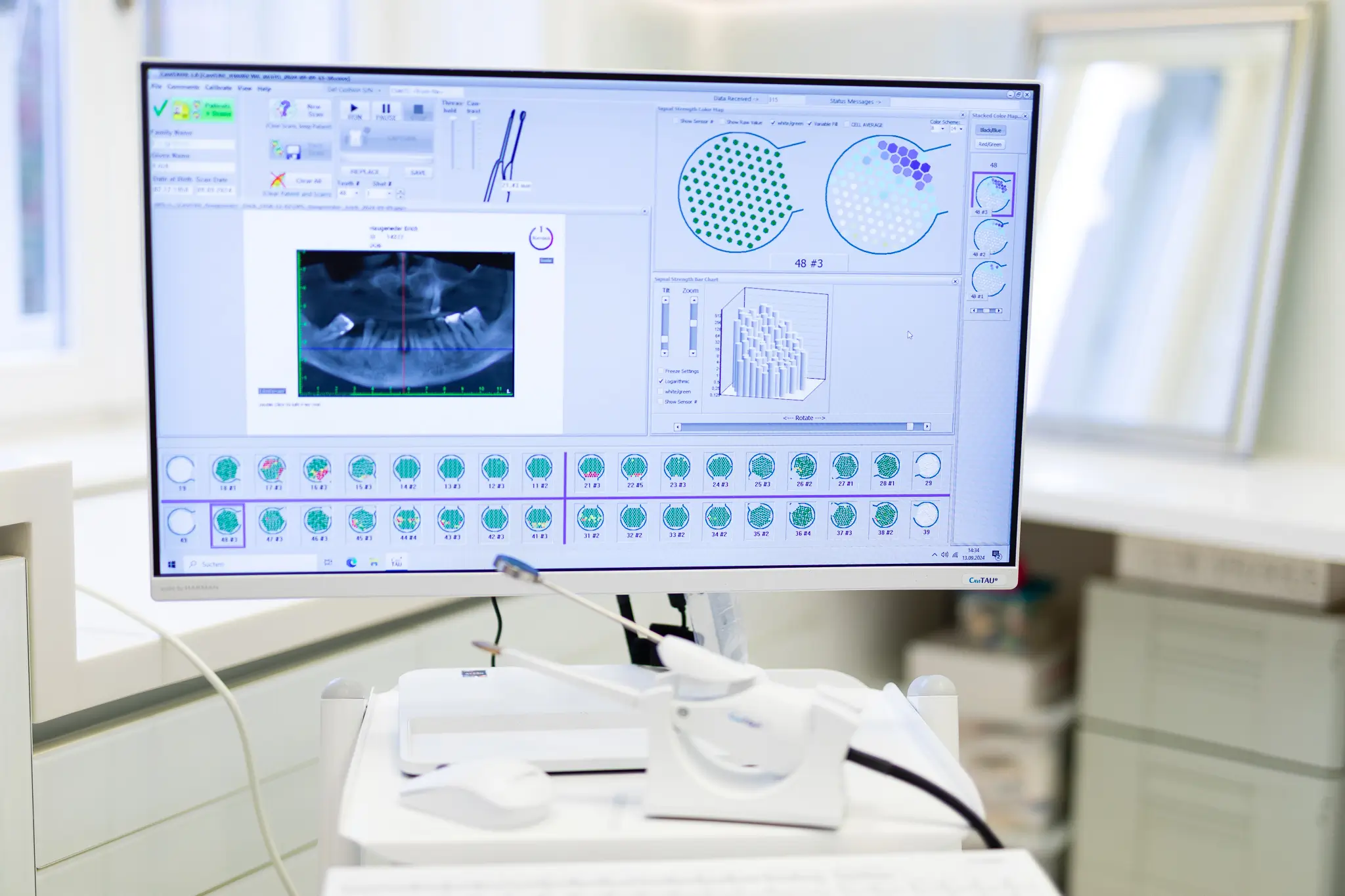 CaviTAU® Diagnostik zur Erkennung von Störfeldern und Entzündungsherden im Kieferknochen